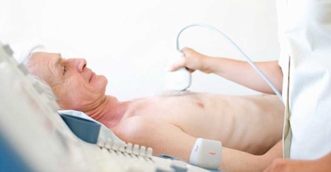 Echocardiogram